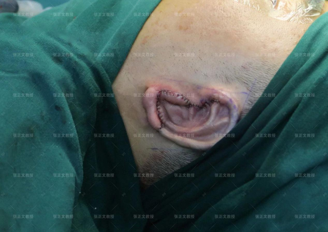 8acc70c5da5a21b937d59a416a91764e.png 图片21.png