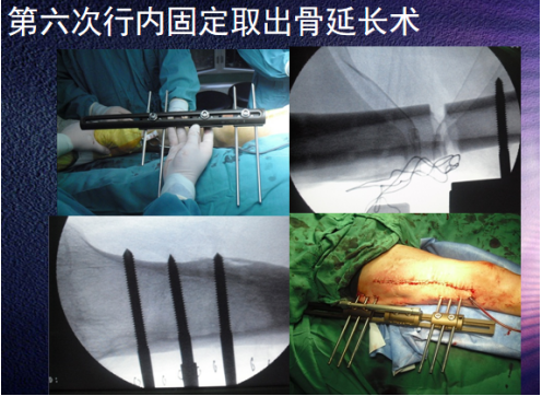 109e5f65d92846715c0c036ea749ef57.png image.png