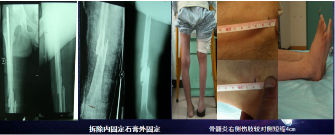 2e41eb9a9320174e80ae1274373c4098.png image.png