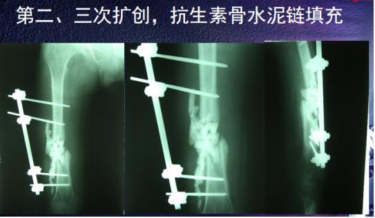 6a343f28c7306cb49311f5b761158672.png image.png